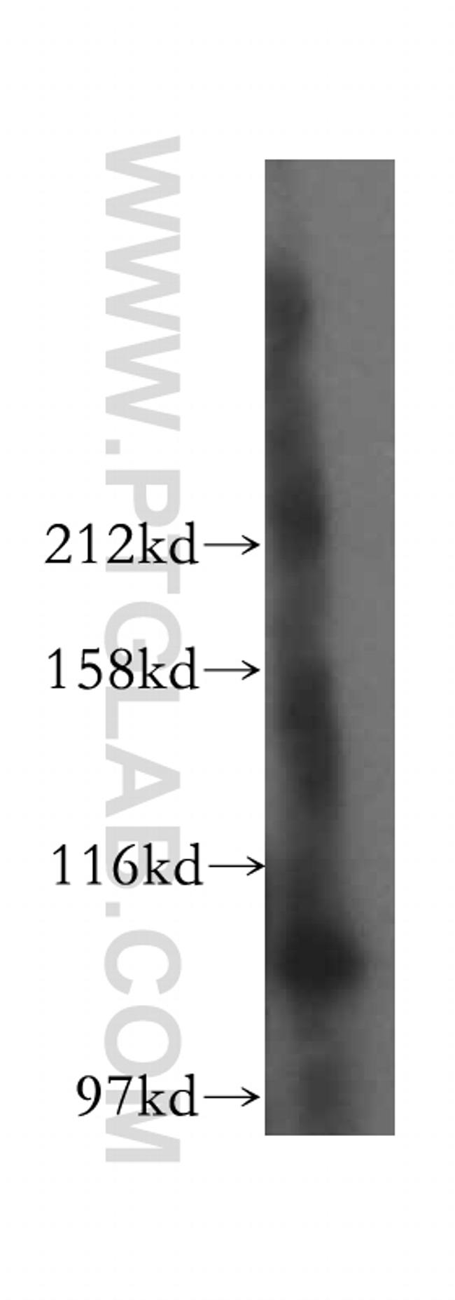 GCC1 Antibody in Western Blot (WB)