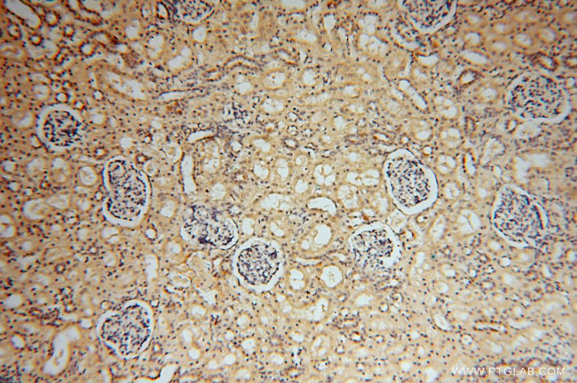 ATP6V1C2 Antibody in Immunohistochemistry (Paraffin) (IHC (P))