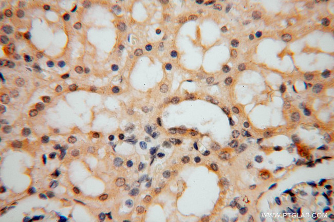 ATP6V1C2 Antibody in Immunohistochemistry (Paraffin) (IHC (P))