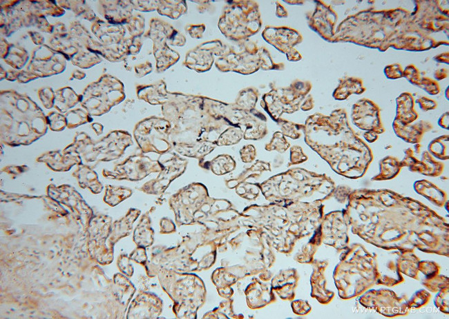 ATP6V1C2 Antibody in Immunohistochemistry (Paraffin) (IHC (P))