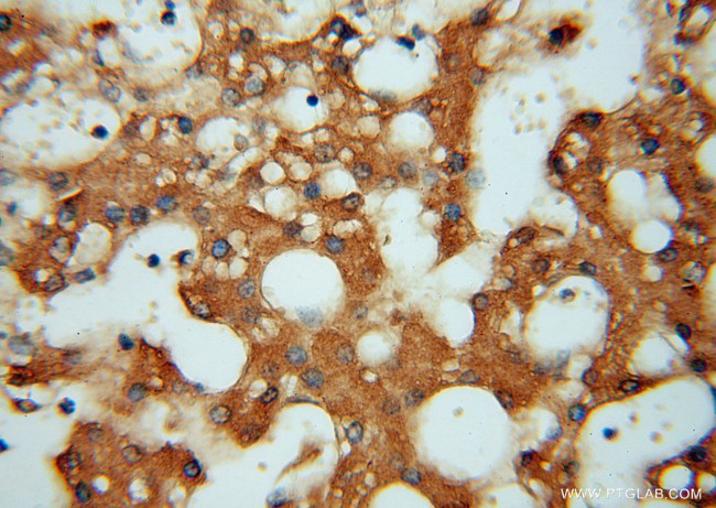 ATP6V1C2 Antibody in Immunohistochemistry (Paraffin) (IHC (P))