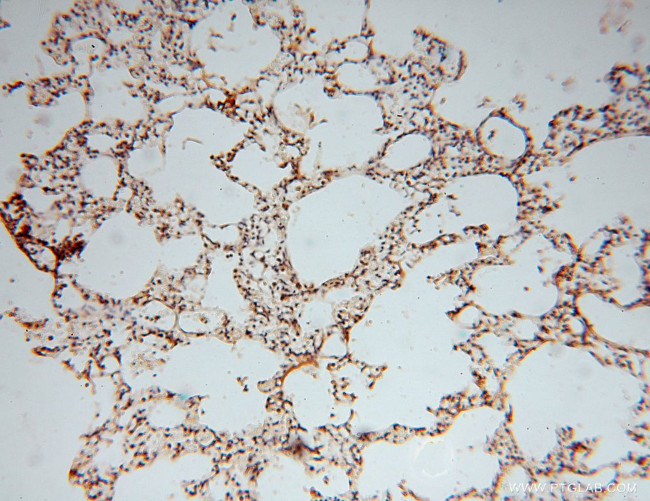 ATP6V1C2 Antibody in Immunohistochemistry (Paraffin) (IHC (P))