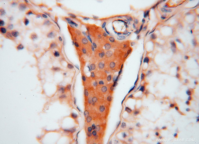 ATP6V1C2 Antibody in Immunohistochemistry (Paraffin) (IHC (P))