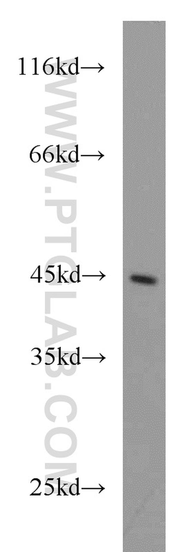 ATP6V1C2 Antibody in Western Blot (WB)