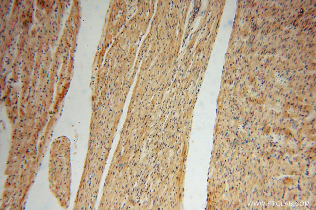 DHRS1 Antibody in Immunohistochemistry (Paraffin) (IHC (P))