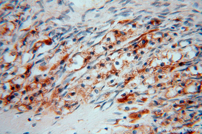 DHRS1 Antibody in Immunohistochemistry (Paraffin) (IHC (P))