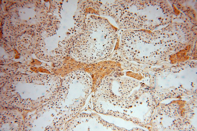 DHRS1 Antibody in Immunohistochemistry (Paraffin) (IHC (P))