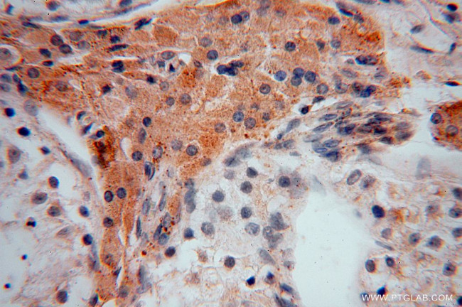 DHRS1 Antibody in Immunohistochemistry (Paraffin) (IHC (P))