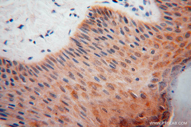 DHRS1 Antibody in Immunohistochemistry (Paraffin) (IHC (P))