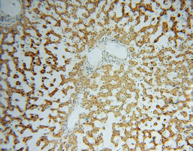 DHRS1 Antibody in Immunohistochemistry (Paraffin) (IHC (P))