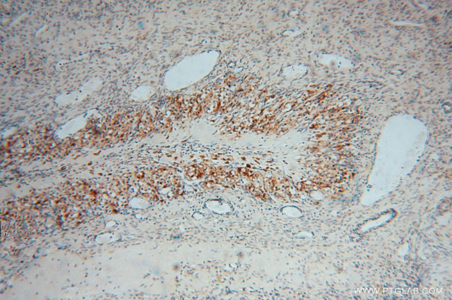 DHRS1 Antibody in Immunohistochemistry (Paraffin) (IHC (P))