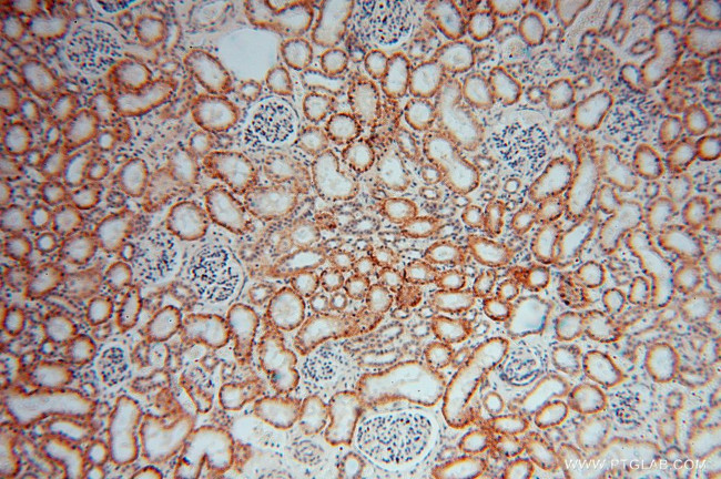 DHRS1 Antibody in Immunohistochemistry (Paraffin) (IHC (P))