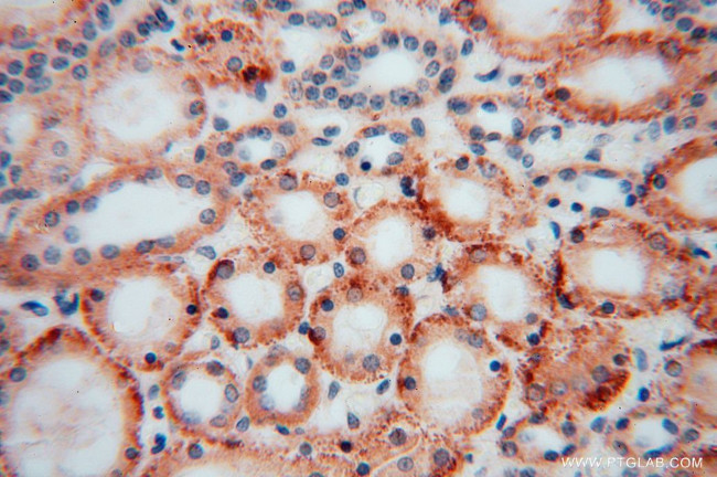 DHRS1 Antibody in Immunohistochemistry (Paraffin) (IHC (P))