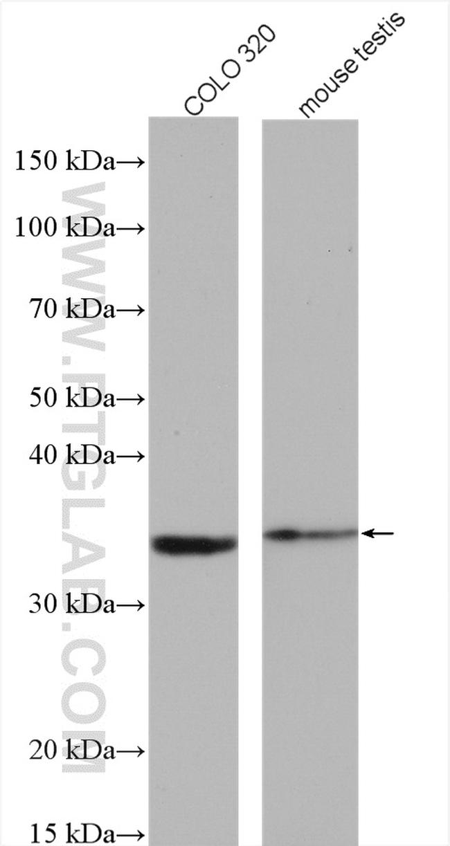 DHRS1 Antibody in Western Blot (WB)