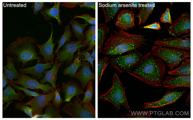 G3BP2 Antibody in Immunocytochemistry (ICC/IF)