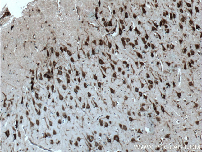 G3BP2 Antibody in Immunohistochemistry (Paraffin) (IHC (P))