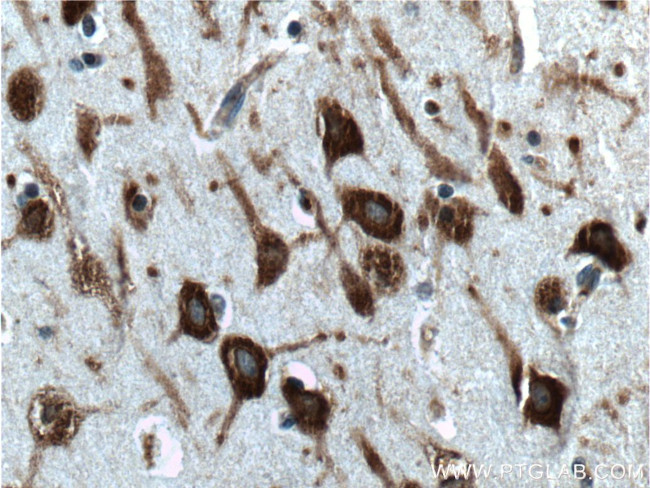 G3BP2 Antibody in Immunohistochemistry (Paraffin) (IHC (P))