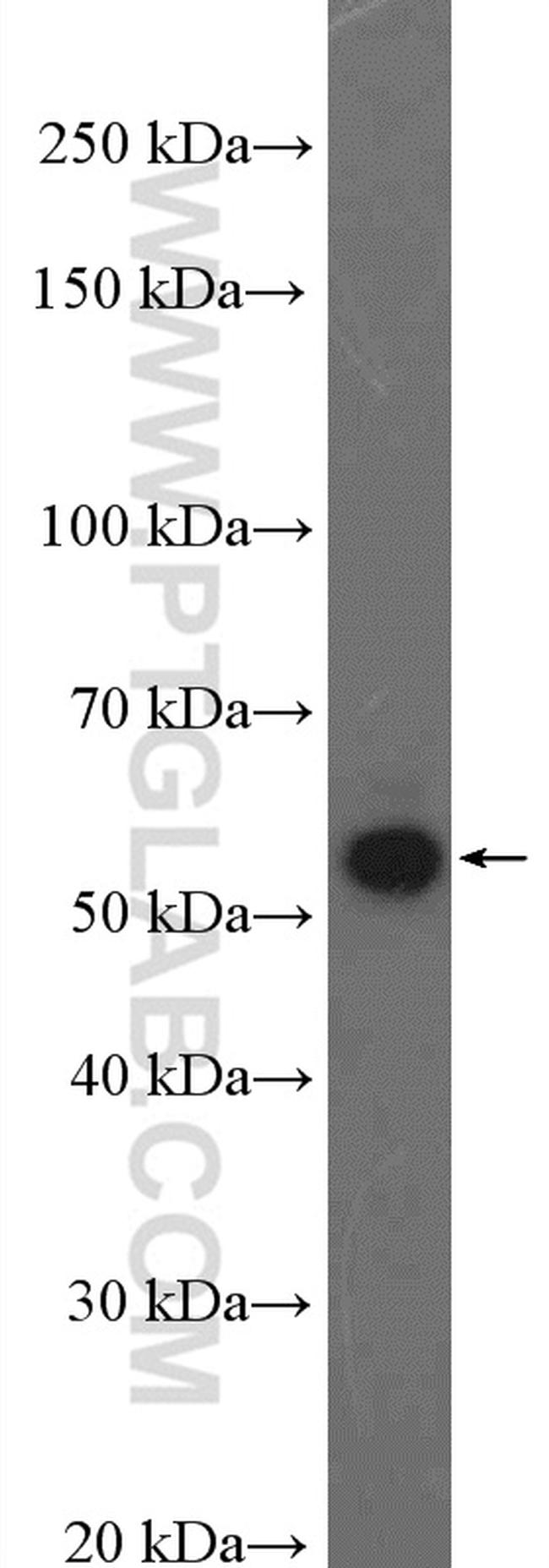 G3BP2 Antibody in Western Blot (WB)