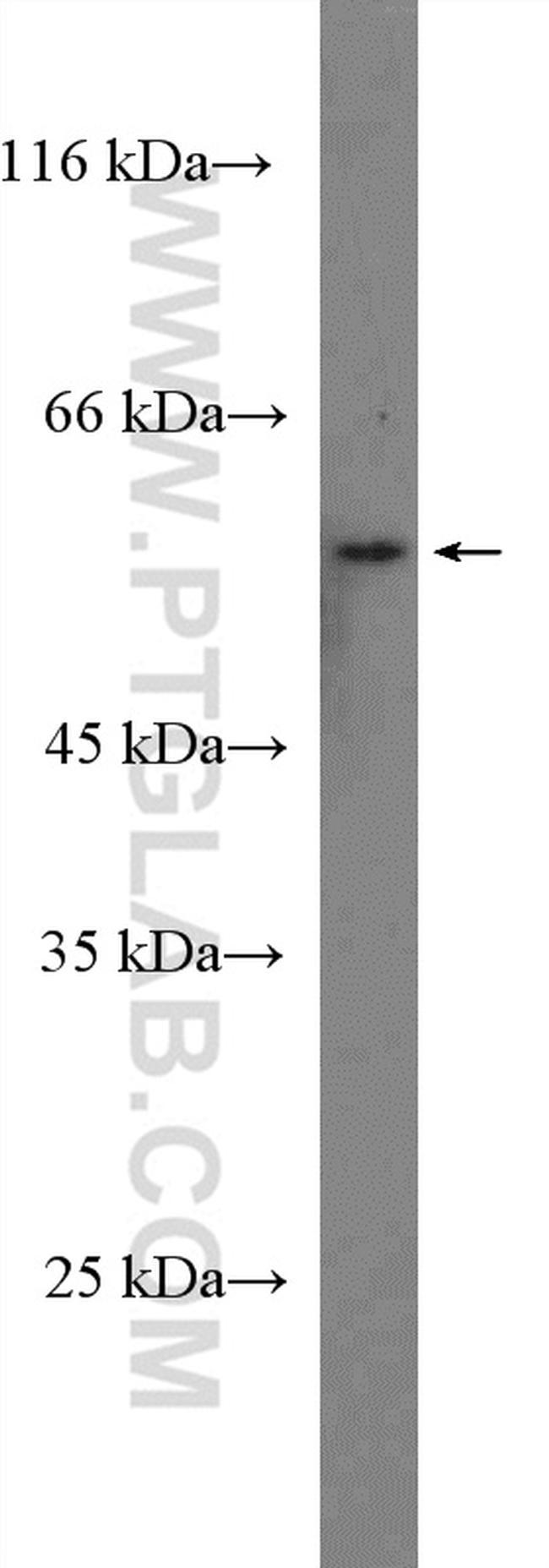 G3BP2 Antibody in Western Blot (WB)