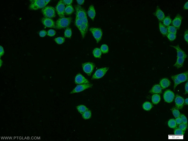 RPL11 Antibody in Immunocytochemistry (ICC/IF)