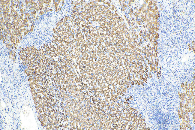 RPL11 Antibody in Immunohistochemistry (Paraffin) (IHC (P))