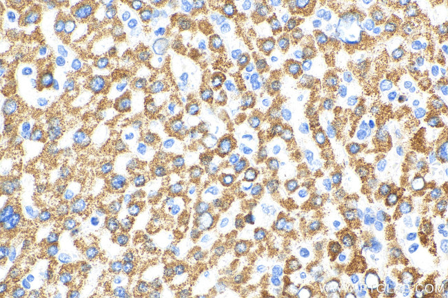 RPL11 Antibody in Immunohistochemistry (Paraffin) (IHC (P))