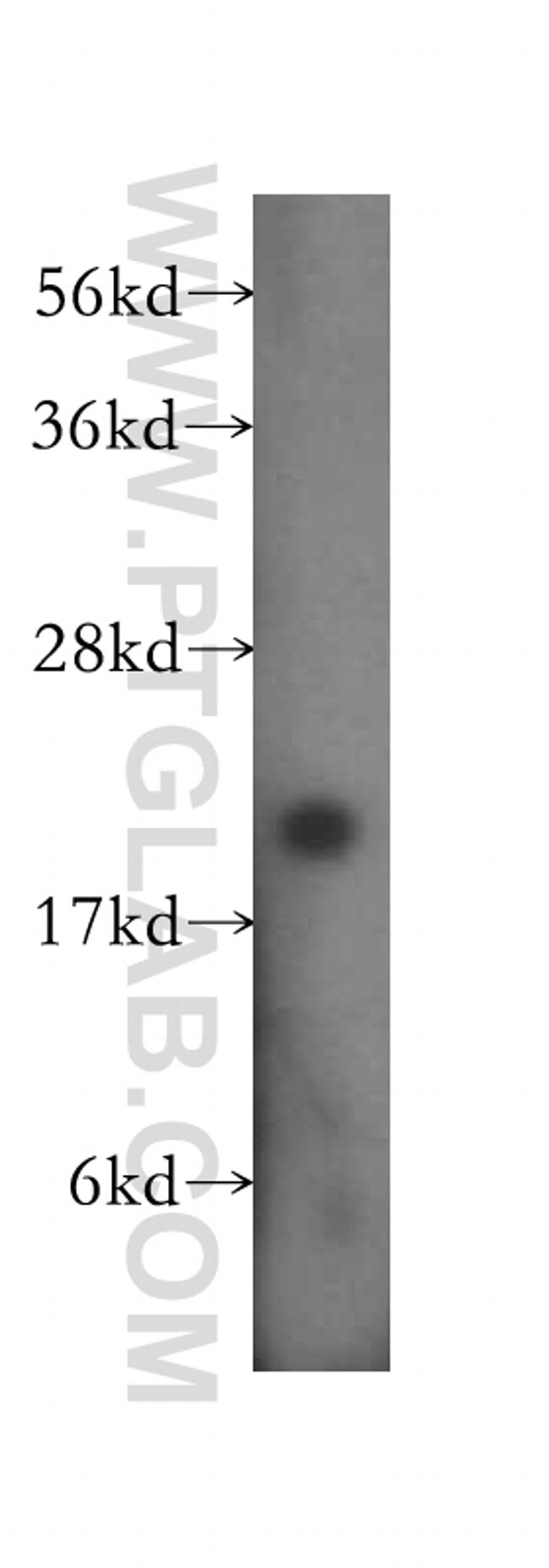 RPL11 Antibody in Western Blot (WB)