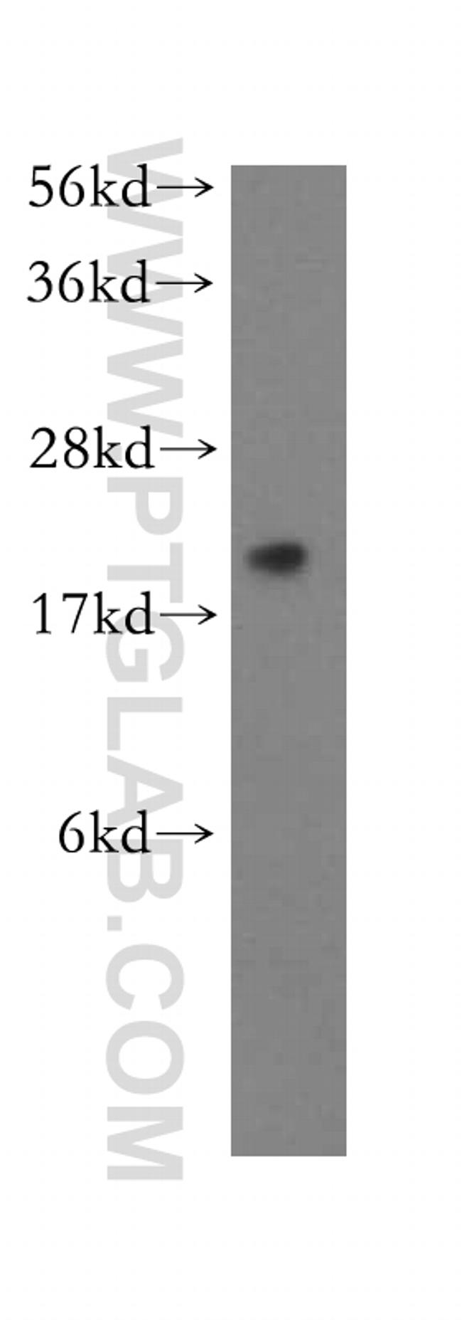 RPL11 Antibody in Western Blot (WB)