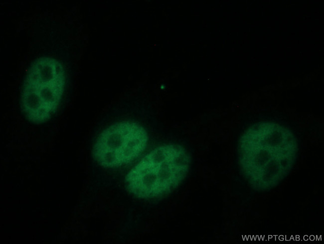 DPY30 Antibody in Immunocytochemistry (ICC/IF)