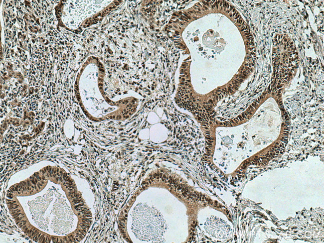 DPY30 Antibody in Immunohistochemistry (Paraffin) (IHC (P))