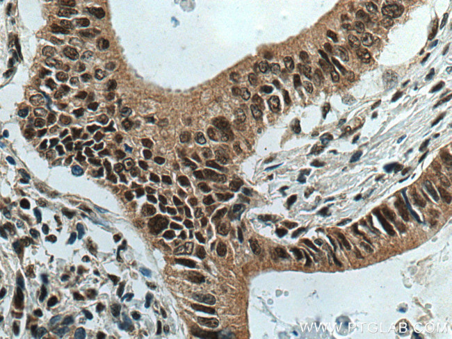 DPY30 Antibody in Immunohistochemistry (Paraffin) (IHC (P))