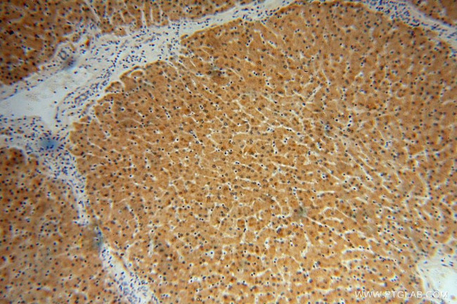 GNPNAT1 Antibody in Immunohistochemistry (Paraffin) (IHC (P))