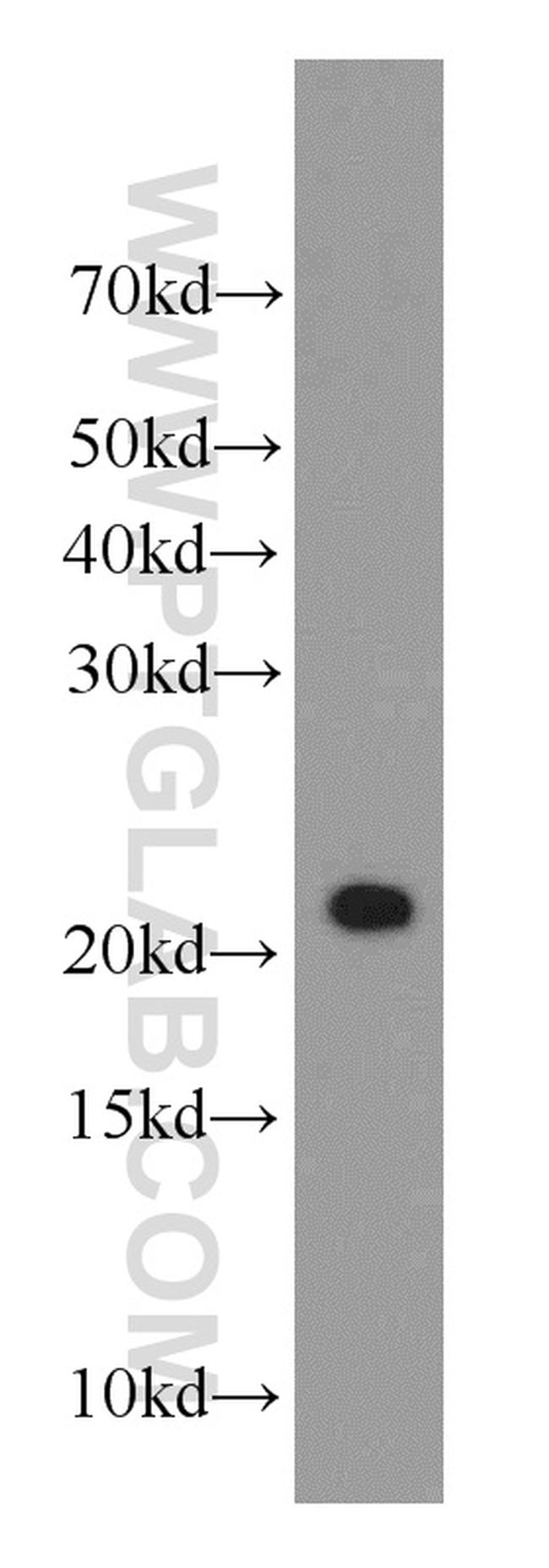GNPNAT1 Antibody in Western Blot (WB)