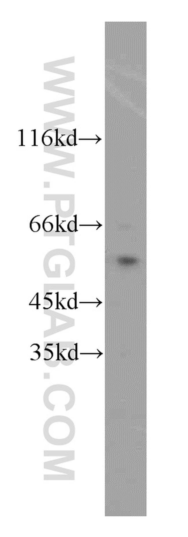 MYC-tag Antibody in Western Blot (WB)