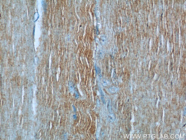 MYL12A Antibody in Immunohistochemistry (Paraffin) (IHC (P))