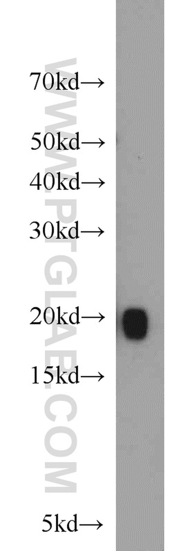 MYL12A Antibody in Western Blot (WB)