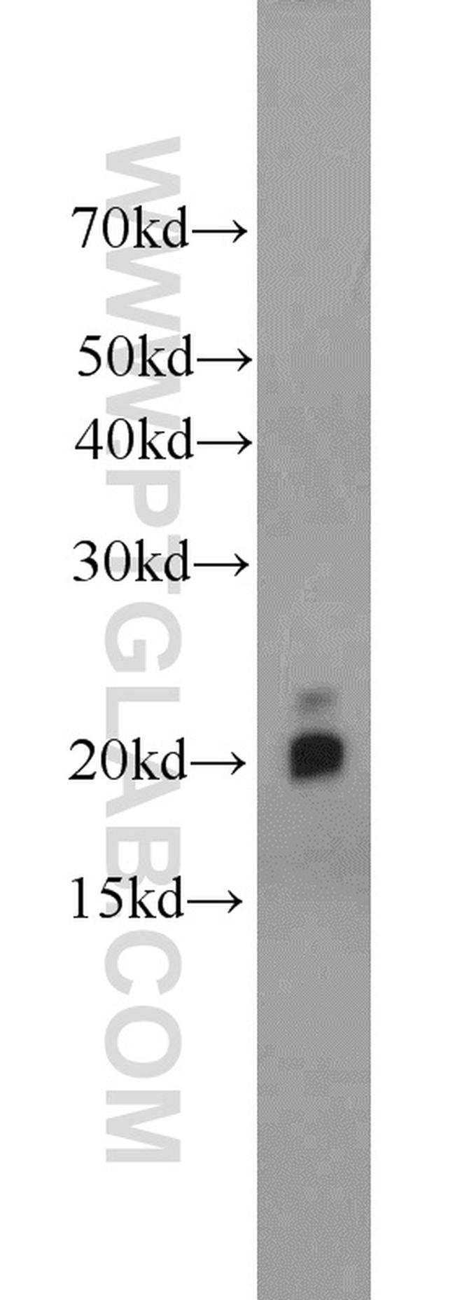 MYL12A Antibody in Western Blot (WB)