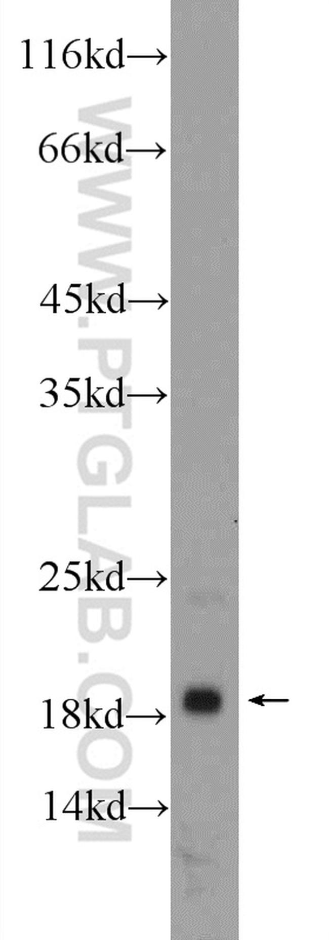 MYL12A Antibody in Western Blot (WB)