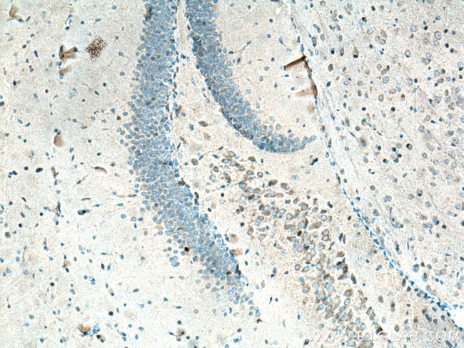 ARC/ARG3.1 Antibody in Immunohistochemistry (Paraffin) (IHC (P))