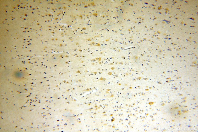 ARC/ARG3.1 Antibody in Immunohistochemistry (Paraffin) (IHC (P))