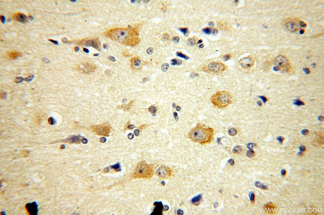 ARC/ARG3.1 Antibody in Immunohistochemistry (Paraffin) (IHC (P))