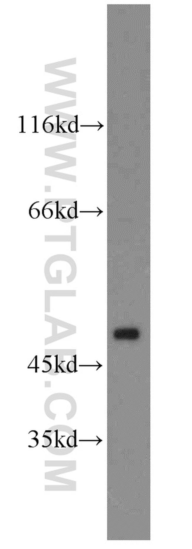 ARC/ARG3.1 Antibody in Western Blot (WB)