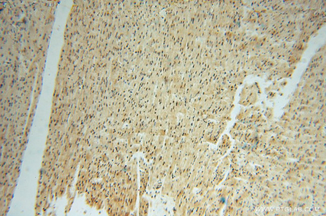 LENG9 Antibody in Immunohistochemistry (Paraffin) (IHC (P))