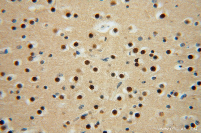 LENG9 Antibody in Immunohistochemistry (Paraffin) (IHC (P))