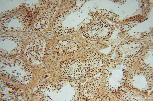 LENG9 Antibody in Immunohistochemistry (Paraffin) (IHC (P))