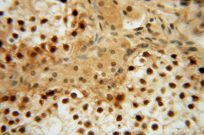 LENG9 Antibody in Immunohistochemistry (Paraffin) (IHC (P))