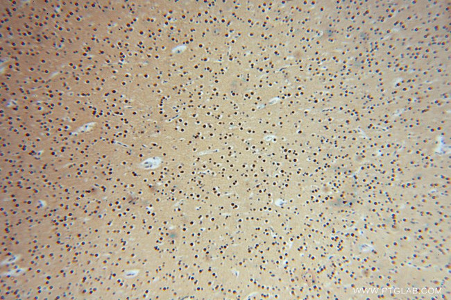 LENG9 Antibody in Immunohistochemistry (Paraffin) (IHC (P))