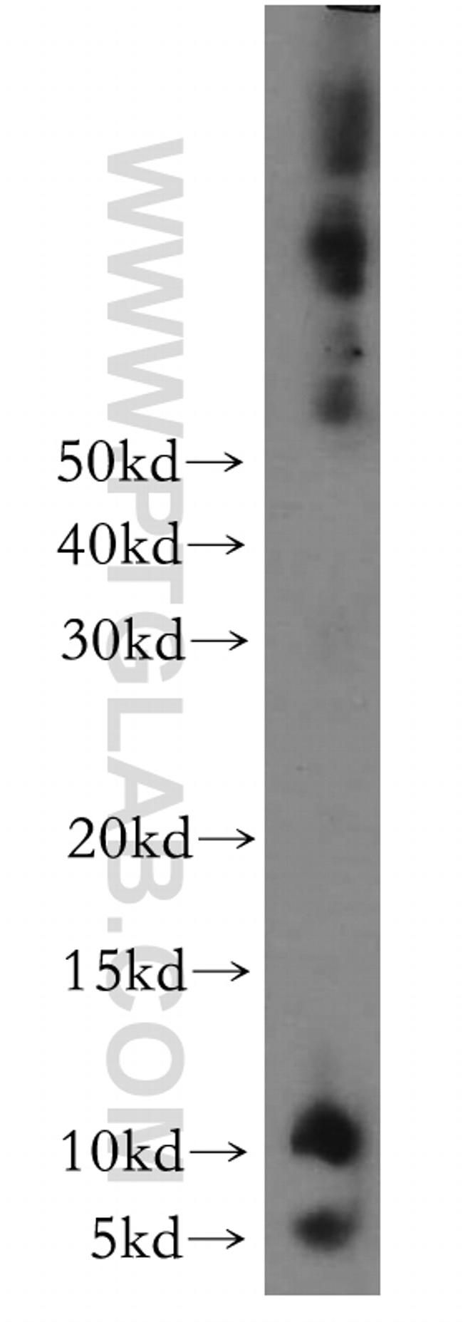 ATP5L Antibody in Western Blot (WB)