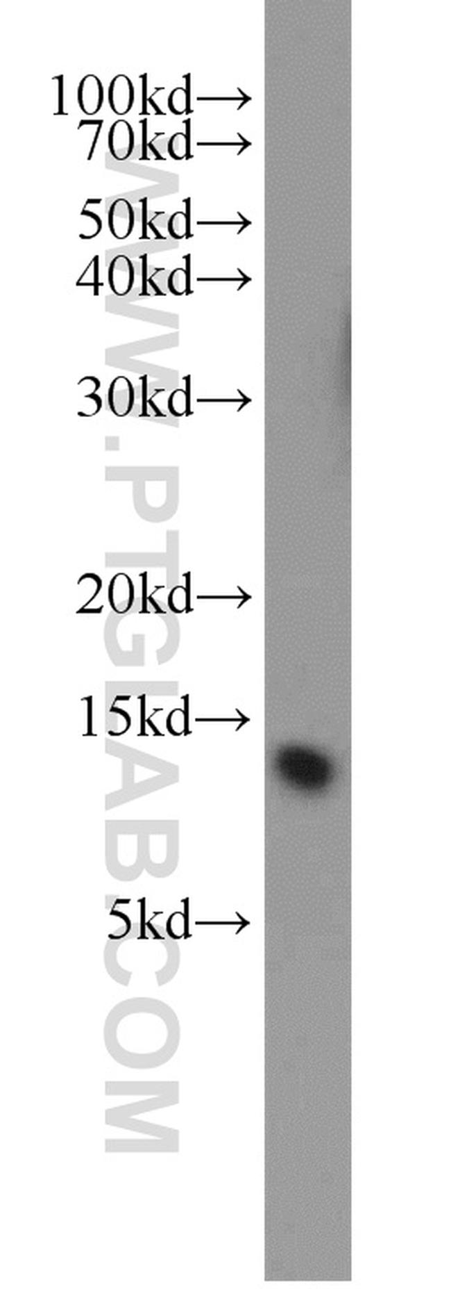 ATP5L Antibody in Western Blot (WB)