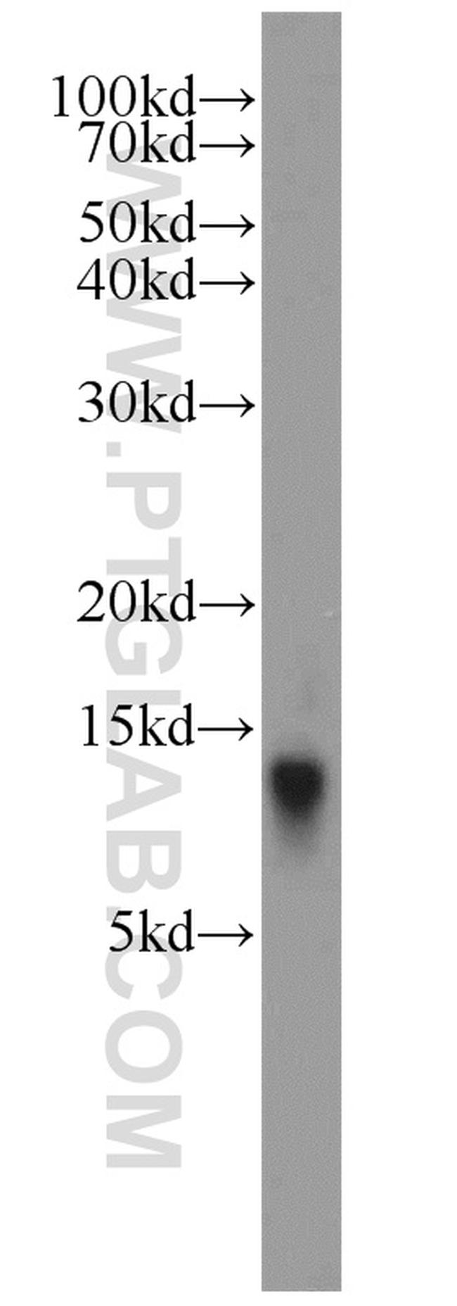 ATP5L Antibody in Western Blot (WB)